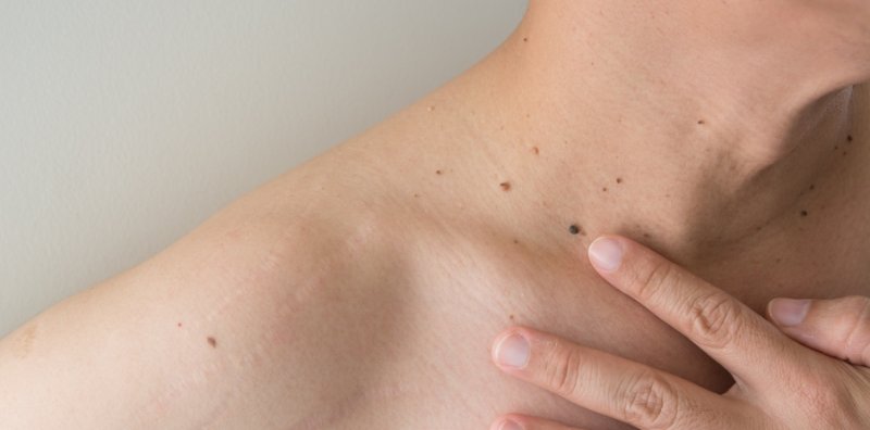 Dermatólogo en CDMX